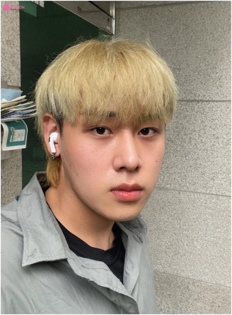 비염기능코성형 뭉툭한 코끝 개선 강남유명성형외과 사진 12