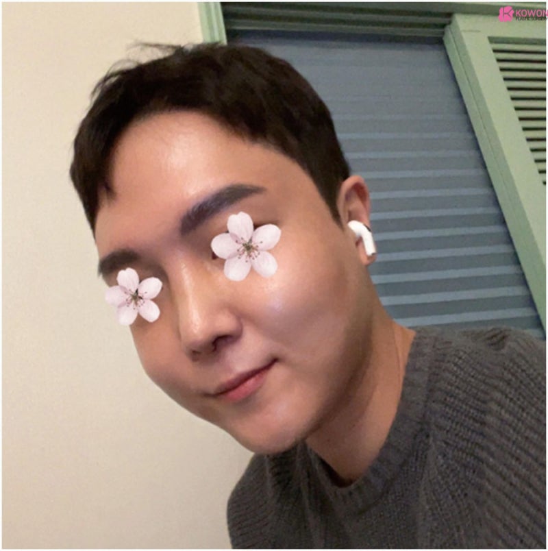 강남유명한성형외과 남자 비중격코재수술 사진 5