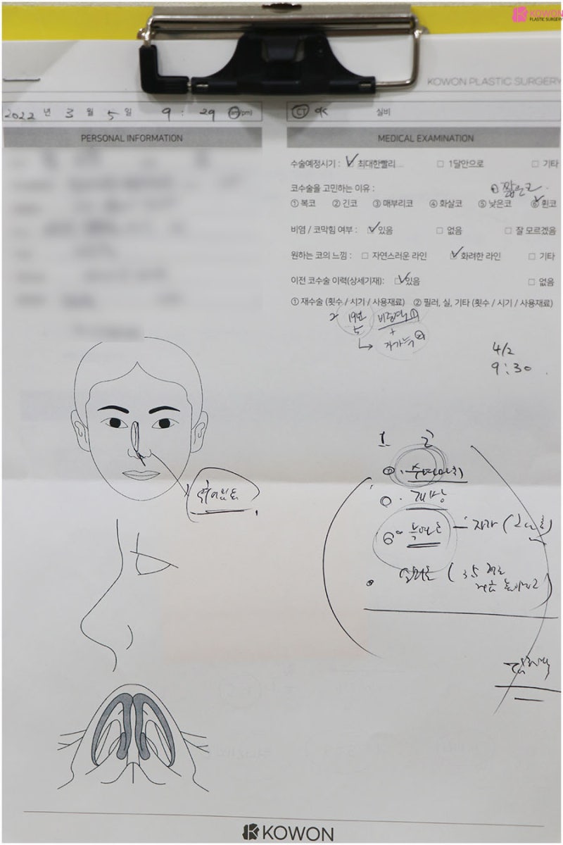 강남유명한성형외과 남자 비중격코재수술