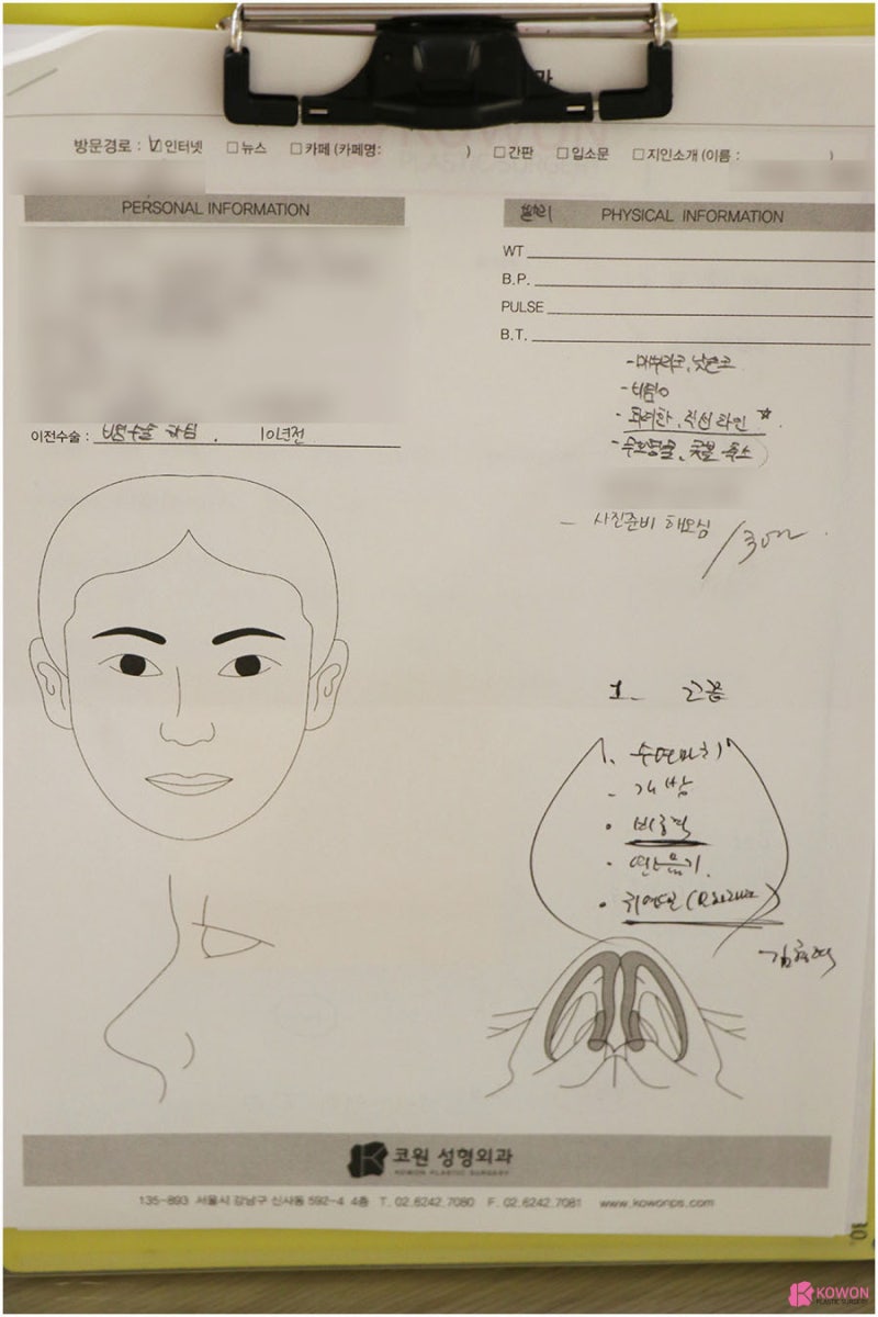 강남코성형외과추천 비염수술후재발 교정 수술 사진 2