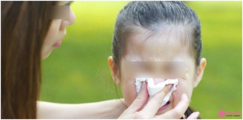 코감기 미각 안 느껴짐 이상 증상 원인 대처 해결 사진 5
