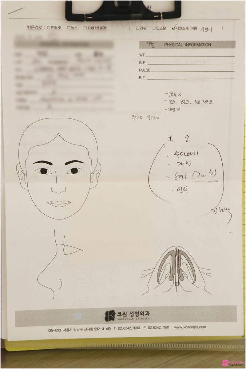 압구정역성형외과 남자복코 개선 자가 늑연골 변화 모양 특징