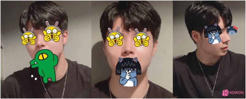 압구정역성형외과 남자복코 개선 자가 늑연골 변화 모양 특징 사진 7