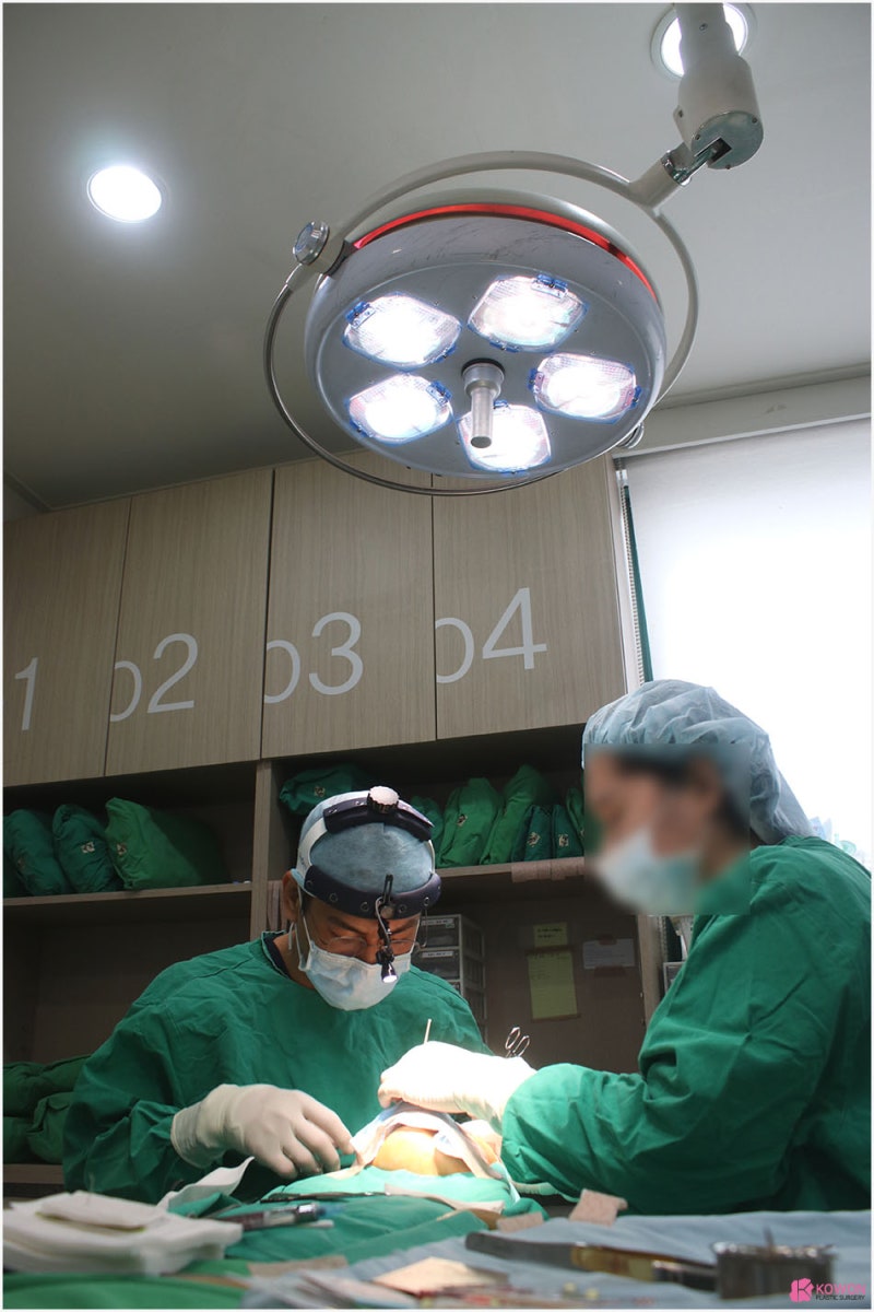자가늑코수술 장점 특징 비순각 신사코성형외과 사진 3