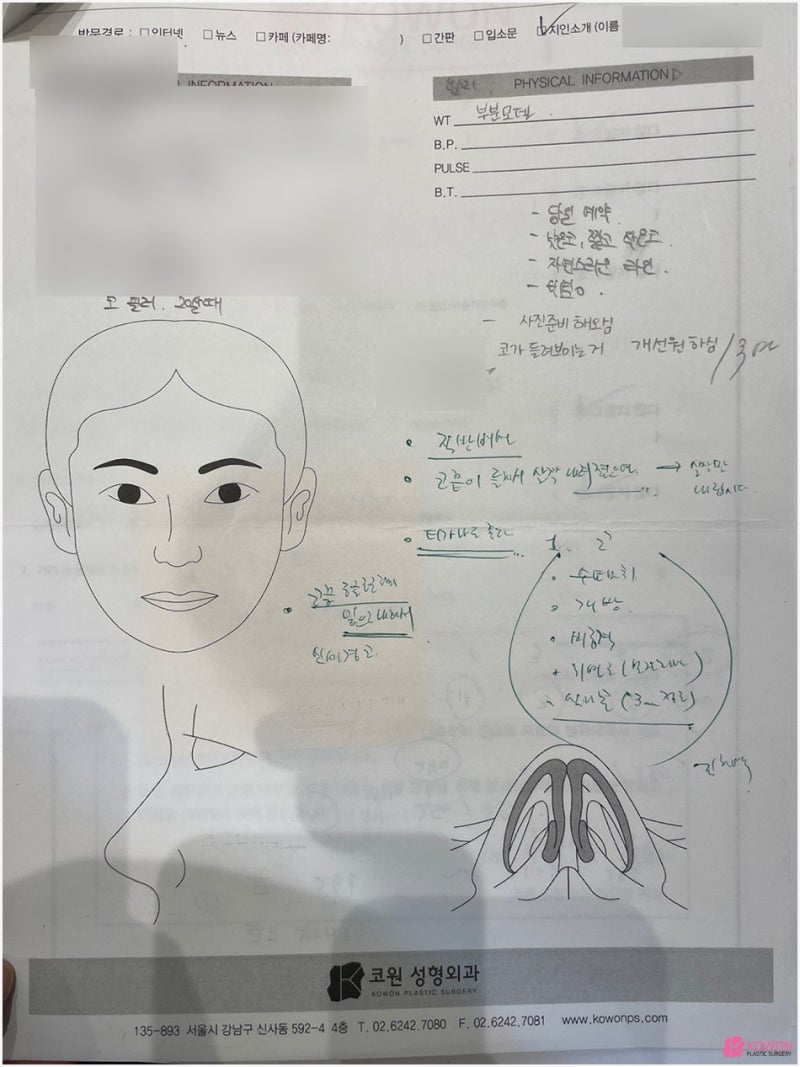 강남신사성형외과 코필러제거 후 자연스러운 결과