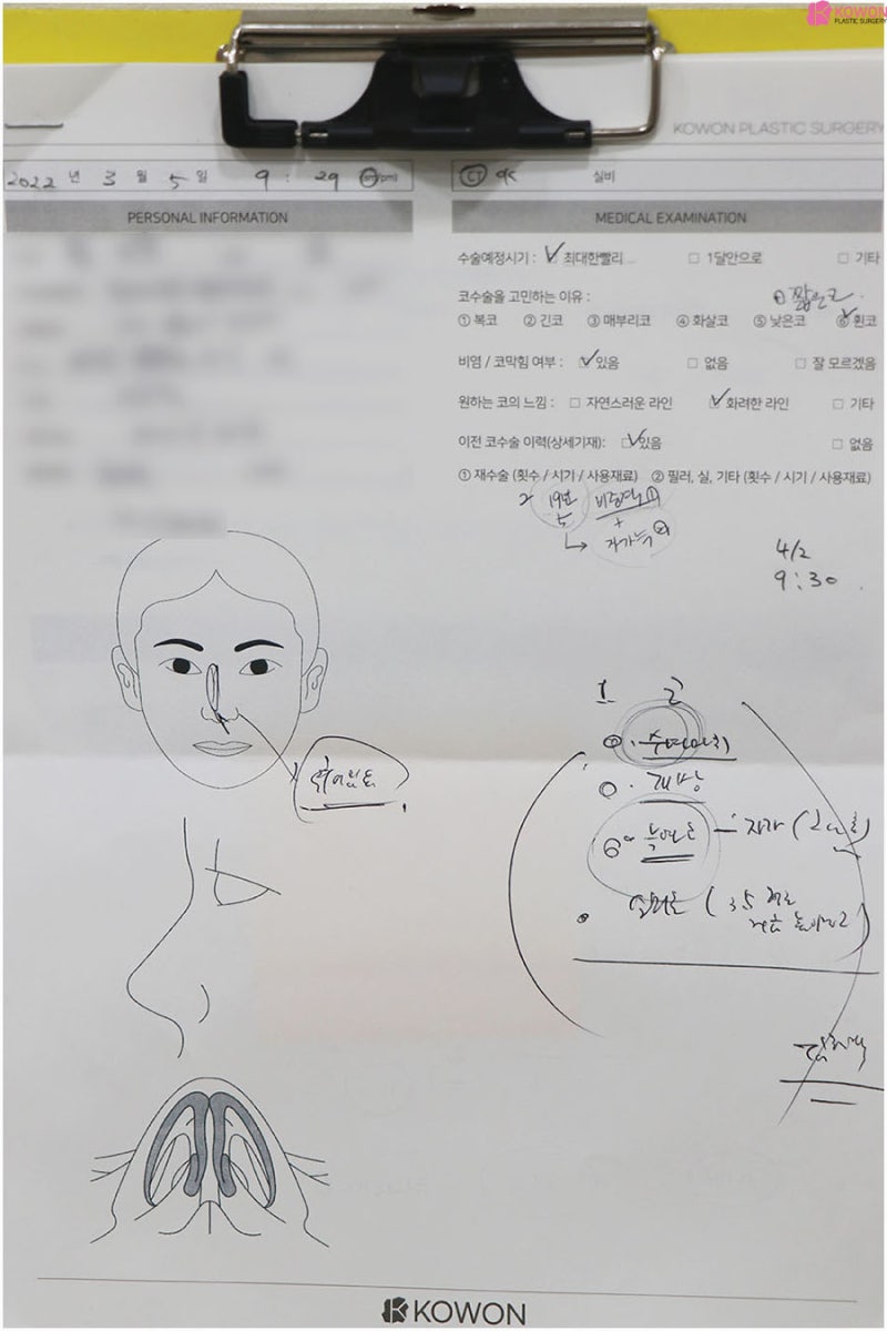 코성형외과추천 코끝구축 부작용 남자 들창코 개선
