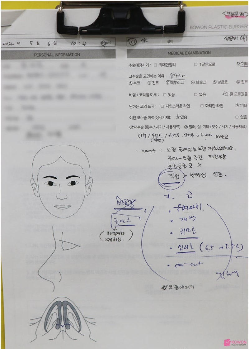 코끝내리기 남성적인 느낌 직선코 반포동성형외과