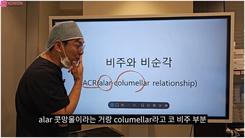 코비주 ACR 관계 연관성 각도 모양 길이 비주성형 특징