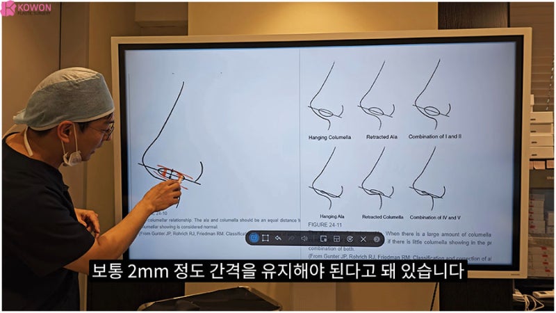 코비주 ACR 관계 연관성 각도 모양 길이 비주성형 특징 사진 3