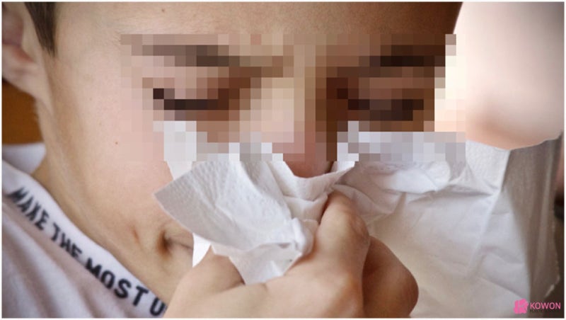 코안헐었을때 대처 코헐음 증상 원인 관리 방법 사진 5