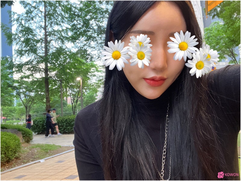 강남유명성형외과 눌린코 매부리코 복코 개선 인상 모양 조화 사진 4