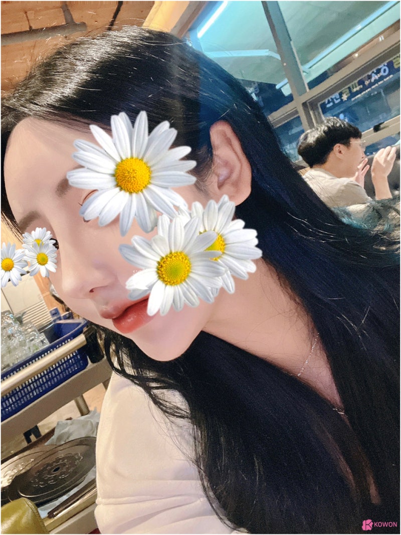 강남유명성형외과 눌린코 매부리코 복코 개선 인상 모양 조화 사진 6