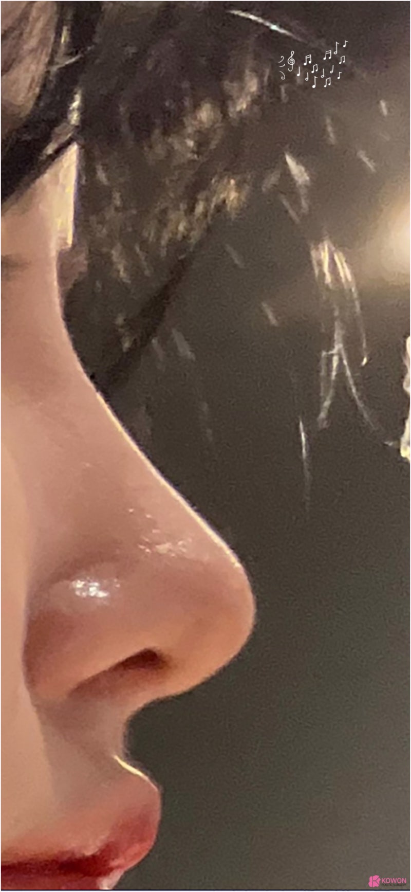 반포성형외과 얼굴 조화 자가늑연골수술 코끝 디자인 사진 10