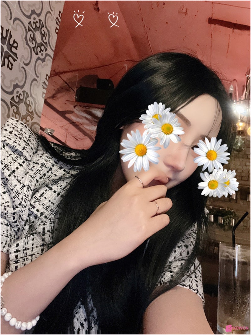 반포성형외과 얼굴 조화 자가늑연골수술 코끝 디자인 사진 5