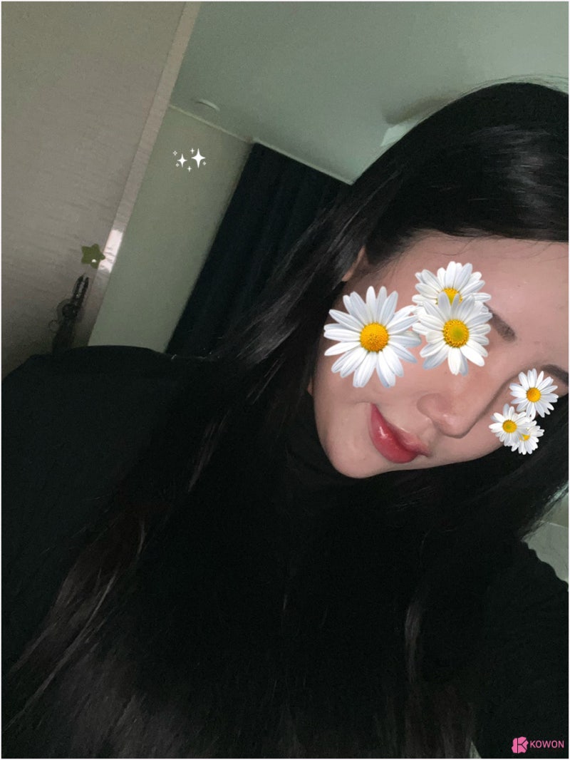 반포성형외과 얼굴 조화 자가늑연골수술 코끝 디자인 사진 3