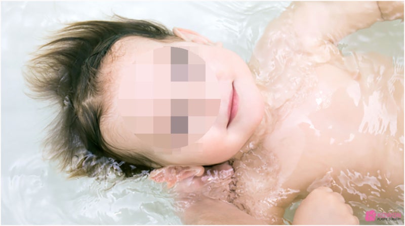 콧물냉 임신초기 피 비침 노란 분비물 출산 예정일 이슬 사진 7