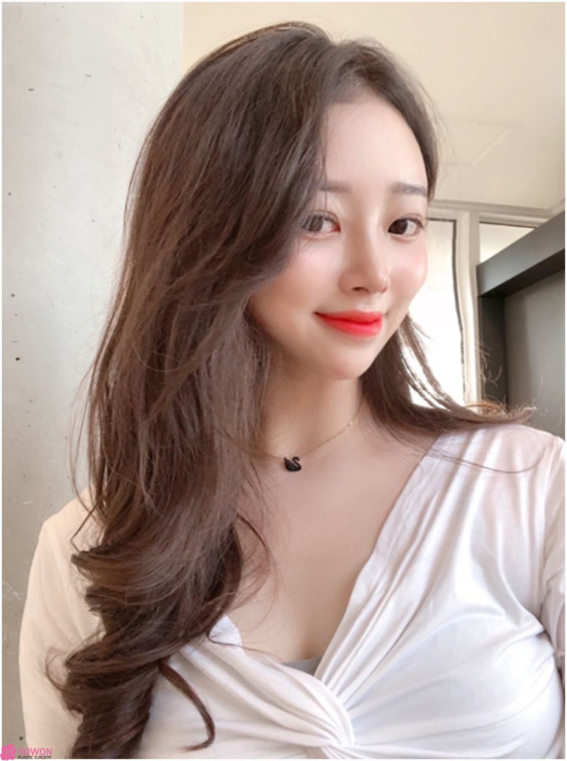낮은코수술방법 여성스러운 이미지 변화 청담역성형외과 사진 10
