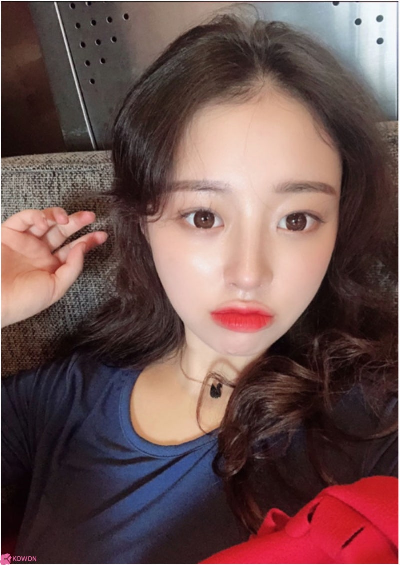 낮은코수술방법 여성스러운 이미지 변화 청담역성형외과 사진 9