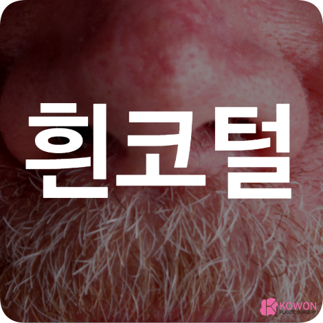 흰코털 흰색코털 자라는이유 새치 뽑기 제거 관리