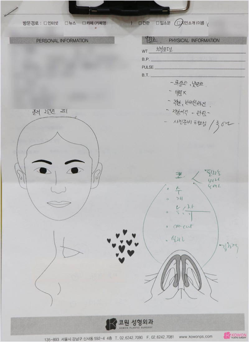 화살코개선 코끝처짐 기증 늑연골 낮은 콧대 교정 수술