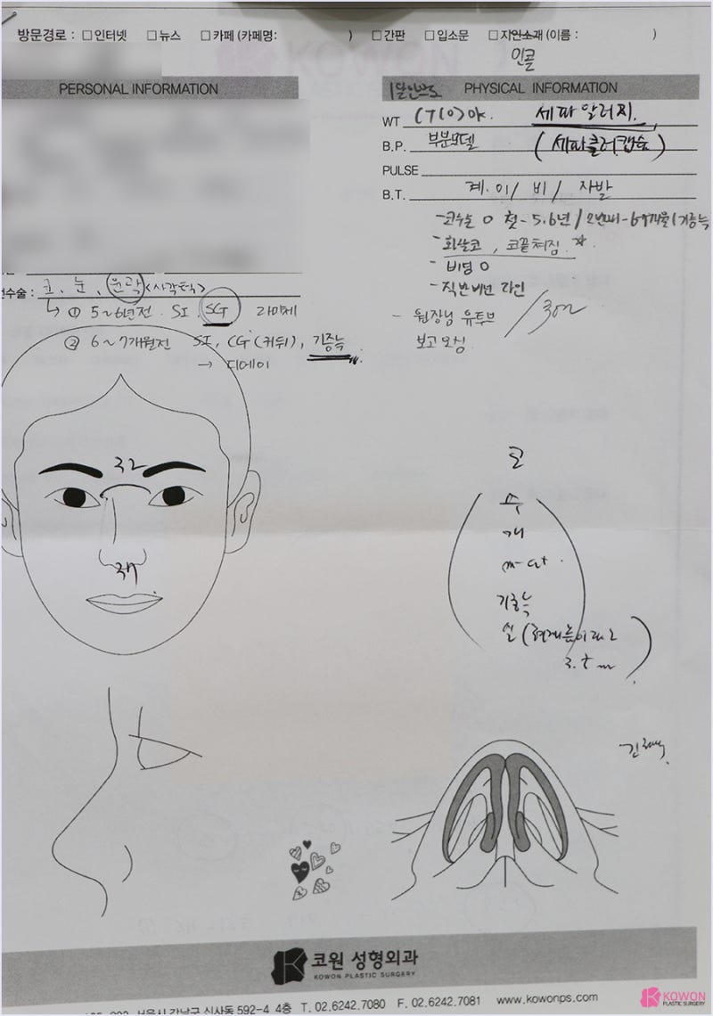 강남역성형외과 코성형재수술 코 끝 처짐 전후 비교 사진 3