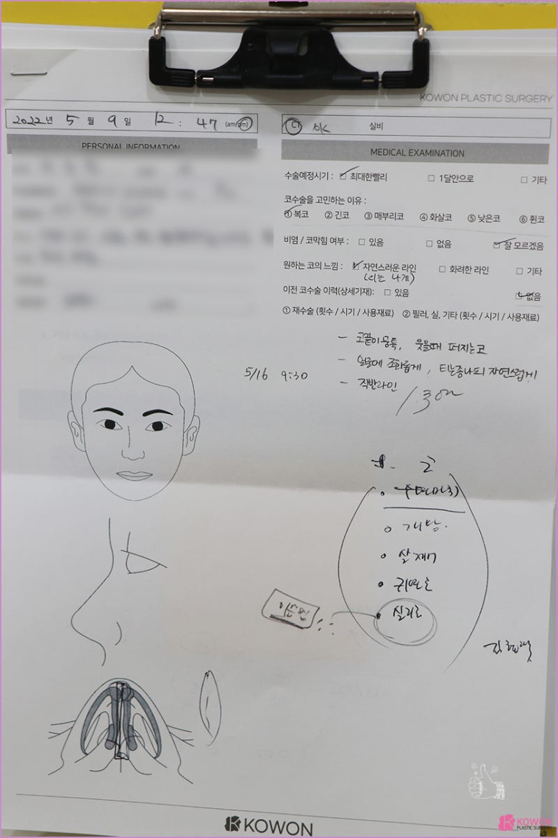 신사성형외과 복코코끝 전후 콤플렉스 콧대 붓기