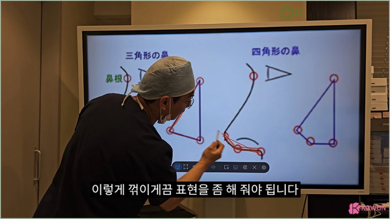 코원성형외과 코 코성형명의 예쁜코모양 비주 비순각 사진 10