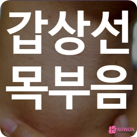 갑상선목부음 오른쪽목혹 왼쪽목혹 요오드 결핍 암 항진증