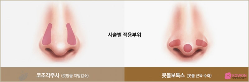 학동역성형외과 강남코조각주사 강남콧볼보톡스 반영구 사진 3