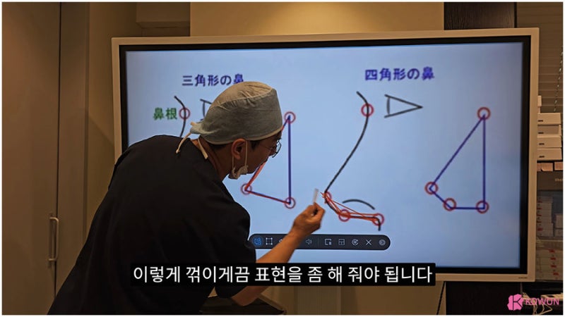 신사역근처성형외과 비주수술 코디자인 비순각 조화로움 사진 10