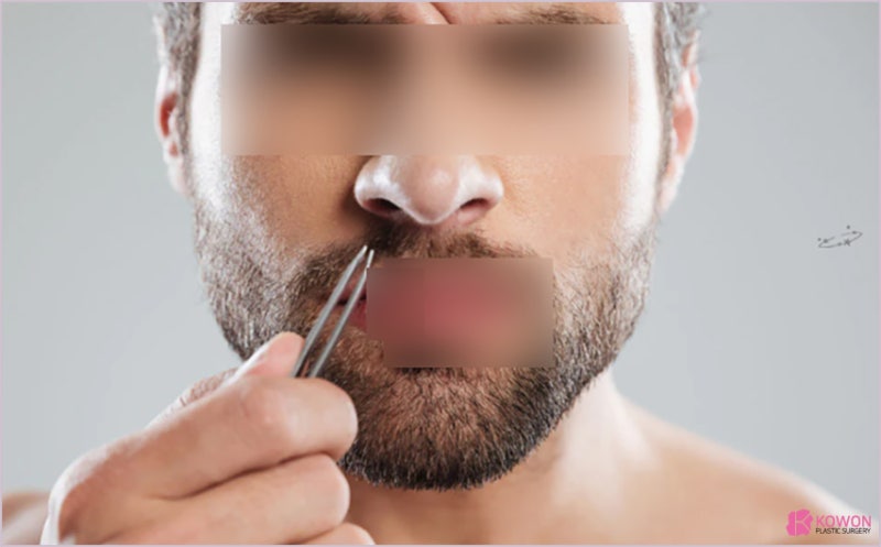 콧구멍여드름 원인 코안쪽 뾰루지 상처 항생제 코털 사진 6