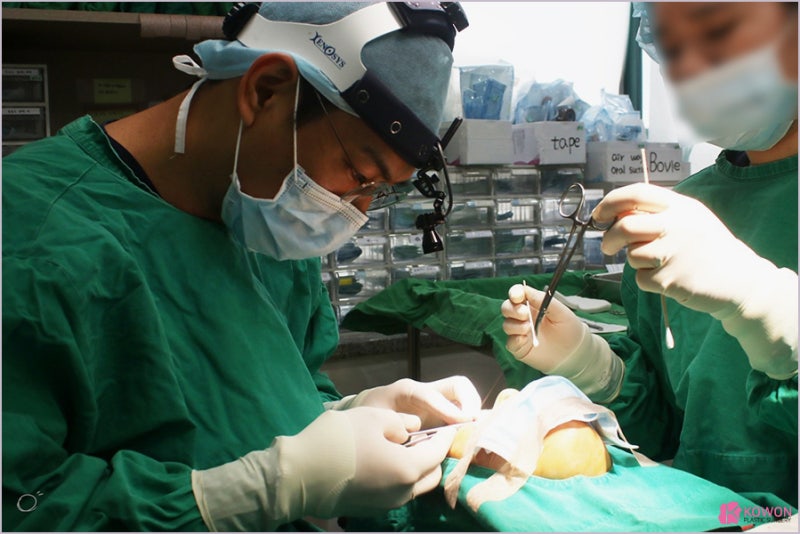 자가연골필러 코필러성형외과 음주 흡연 운동 가상성형 사진 8