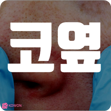 코옆 트러블 붉은기 각질 가려움 여드름 뾰루지 치료