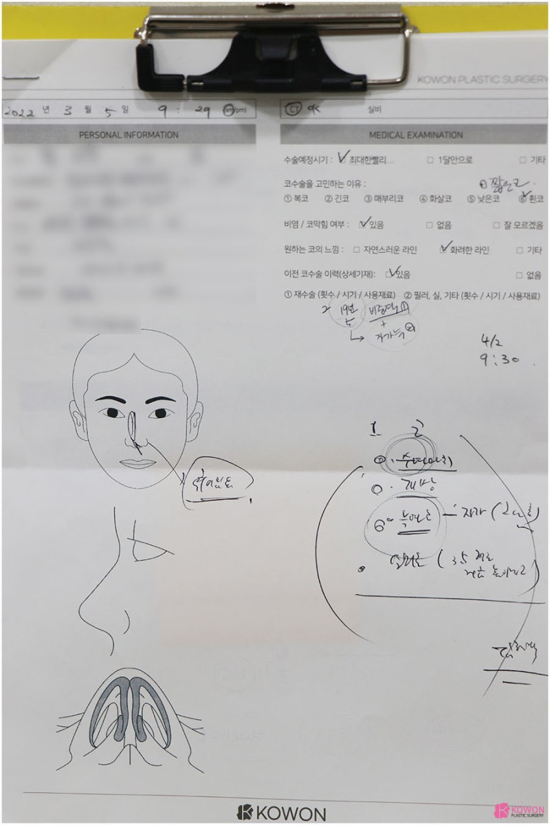 압구정동성형외과 코구축재수술 염증 코끝구축 개선