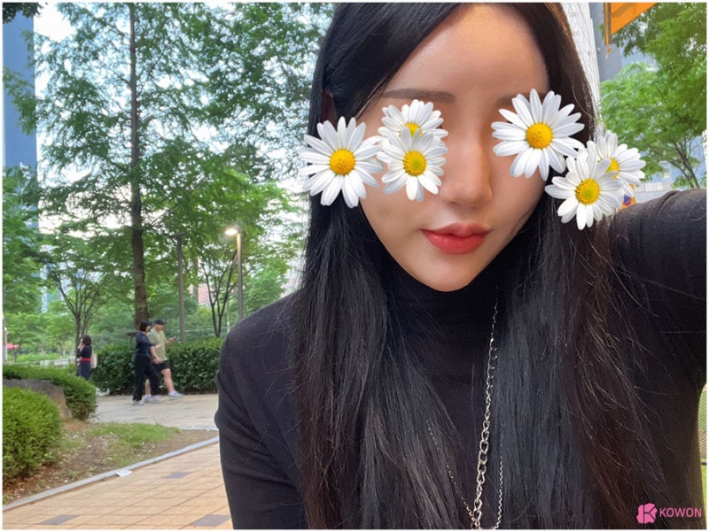 역삼동성형외과 수면마취코수술 개방 퍼지는코 뭉툭한 모양 사진 4