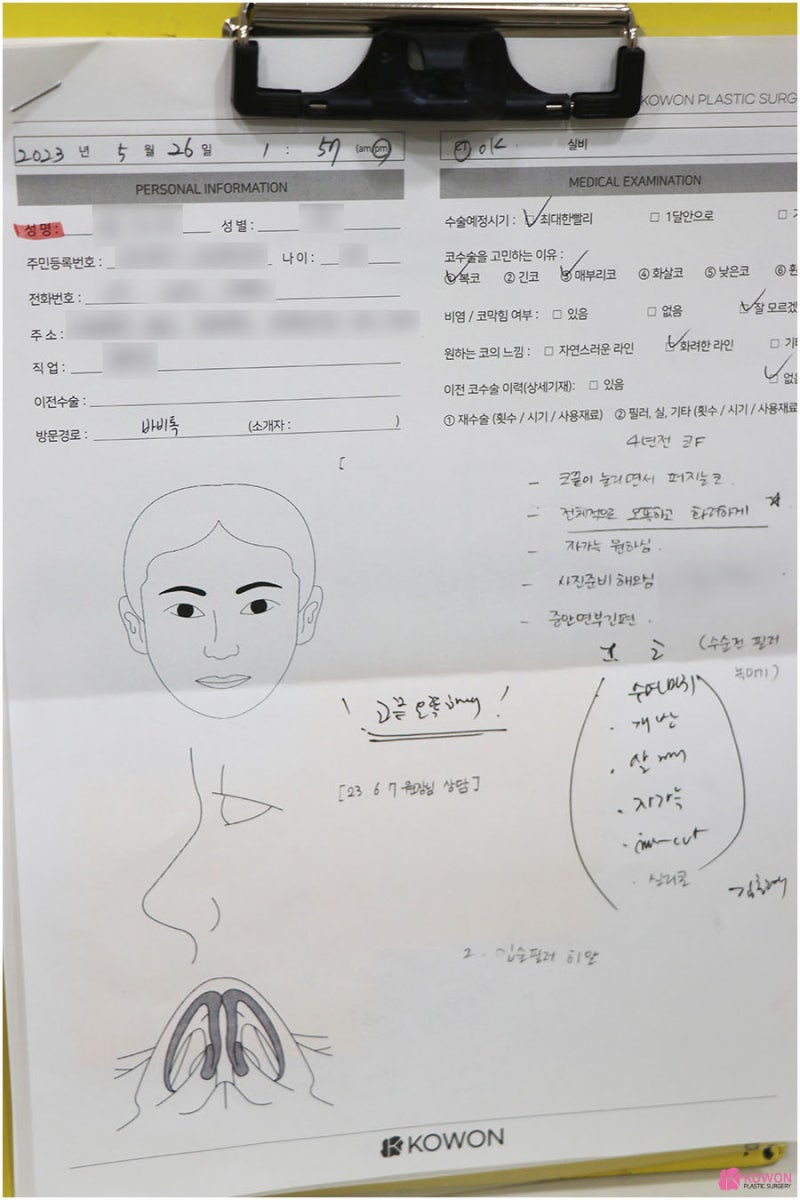 역삼동성형외과 수면마취코수술 개방 퍼지는코 뭉툭한 모양