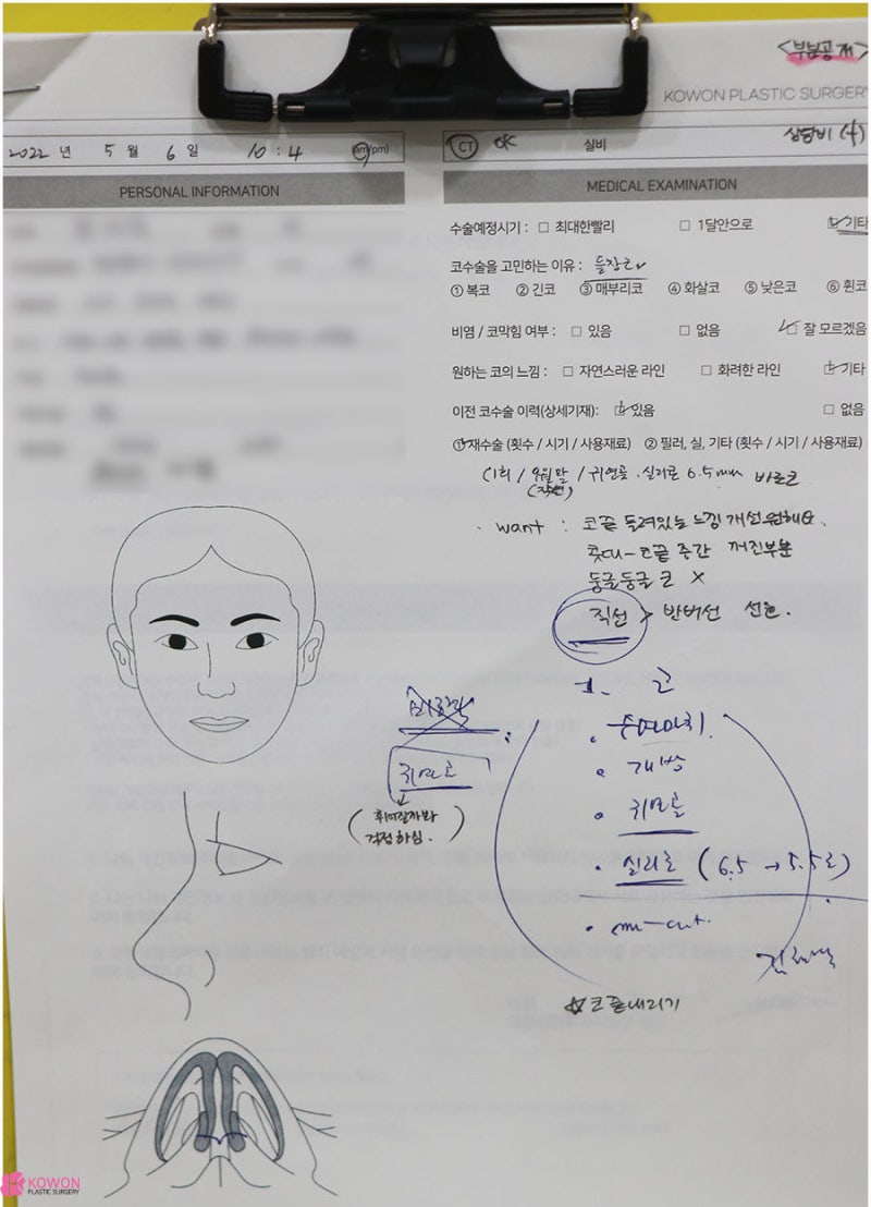 강남구청역성형외과 짝짝이콧구멍 교정 코끝내리는수술