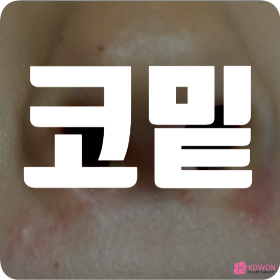 코밑 물집 포진 수포 피지 빨개짐 증상 원인