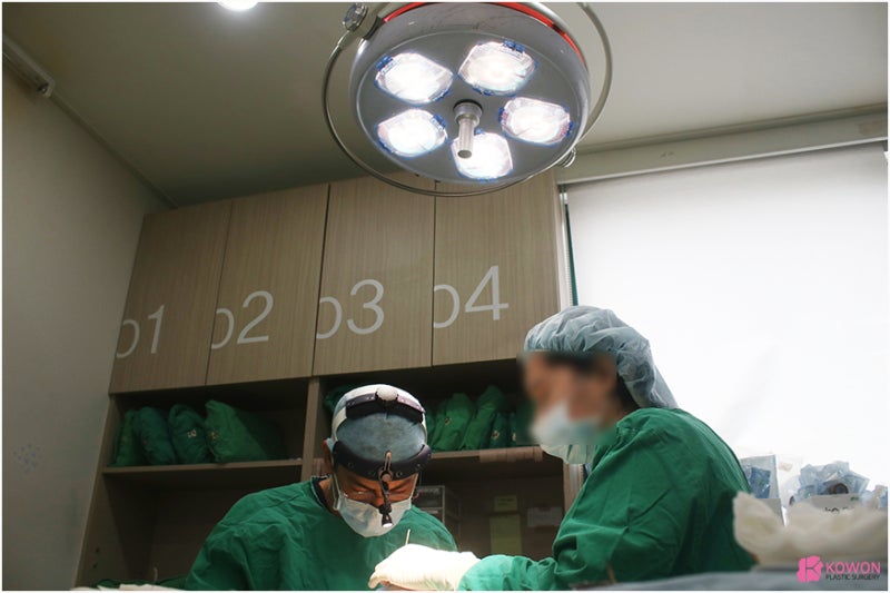 들창코성형 콧볼줄이기 휘어진코 교정 전후 사례 사진 7