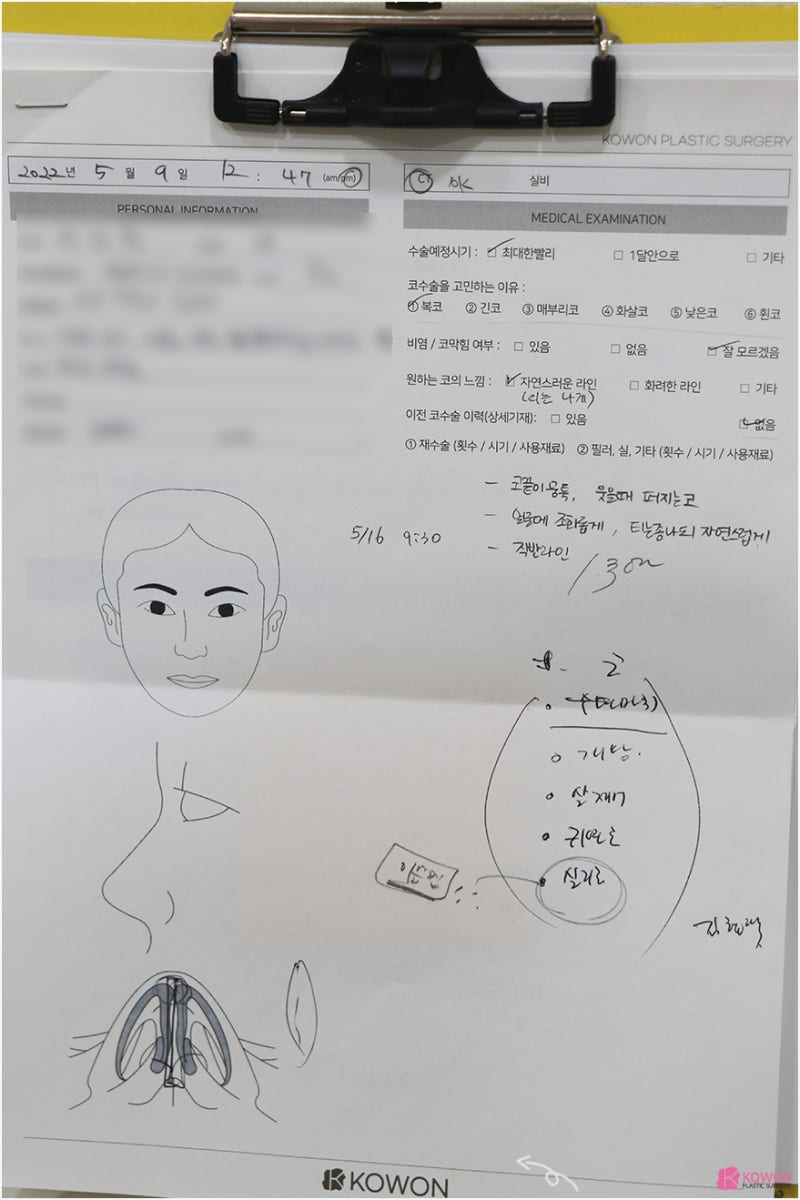 복코수술후기 콧볼축소성형외과 코끝 콤플렉스 해결