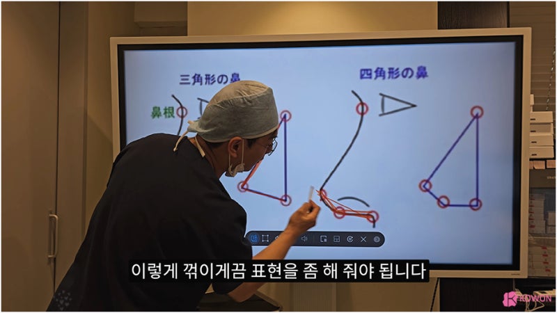 비주 처짐 콧날개 모양 수술 강남코성형외과 사진 10