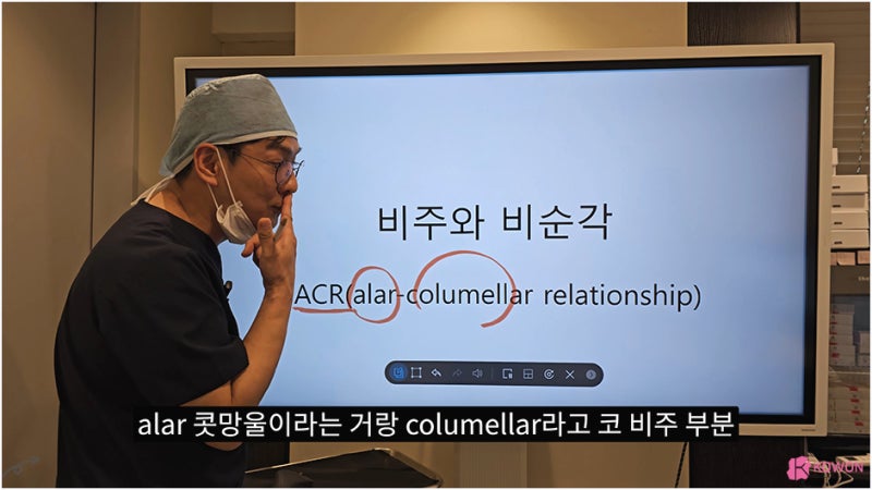 비주 처짐 콧날개 모양 수술 강남코성형외과