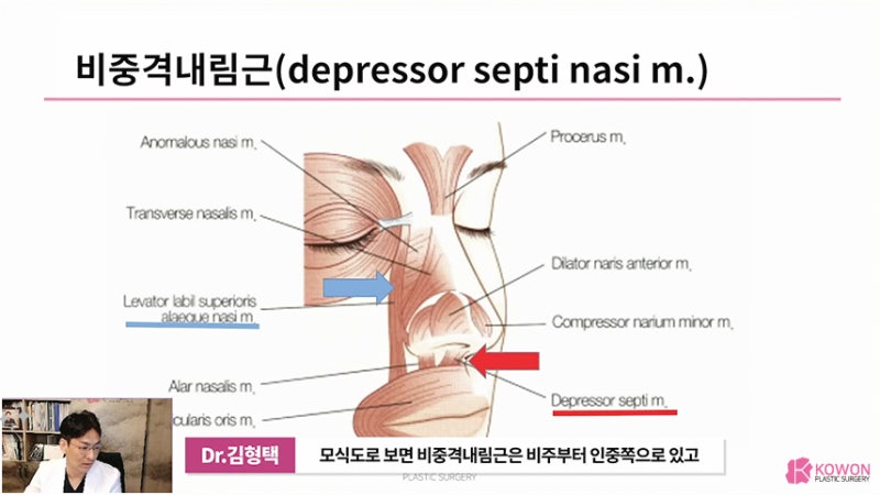 긴코 근육 콧날개내리기 화살코교정 고려 사항 사진 5