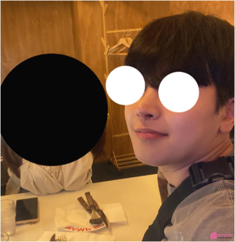 남자코재수술 코수술후실리콘 청담동성형외과 사진 13