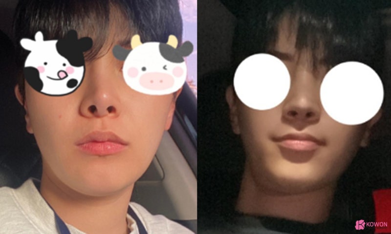 남자코재수술 코수술후실리콘 청담동성형외과 사진 17