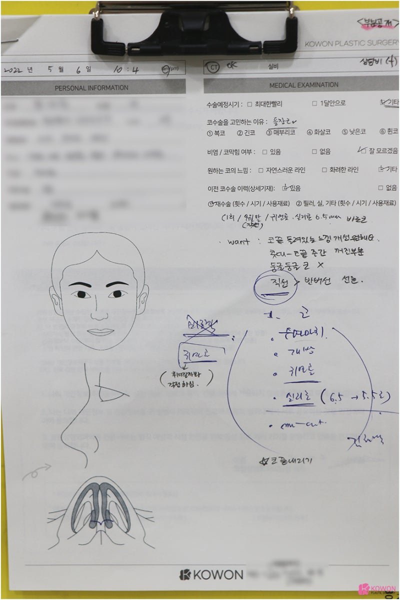남자코재수술 코수술후실리콘 청담동성형외과