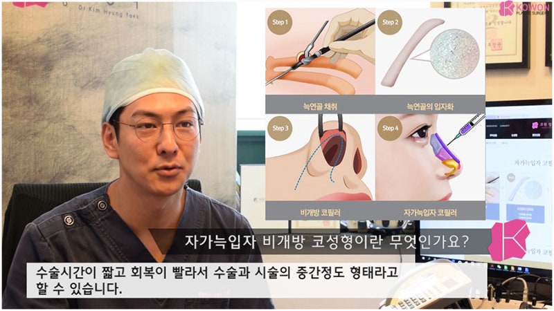 비개방코성형 재료 연골 자가늑코수술 사진 5