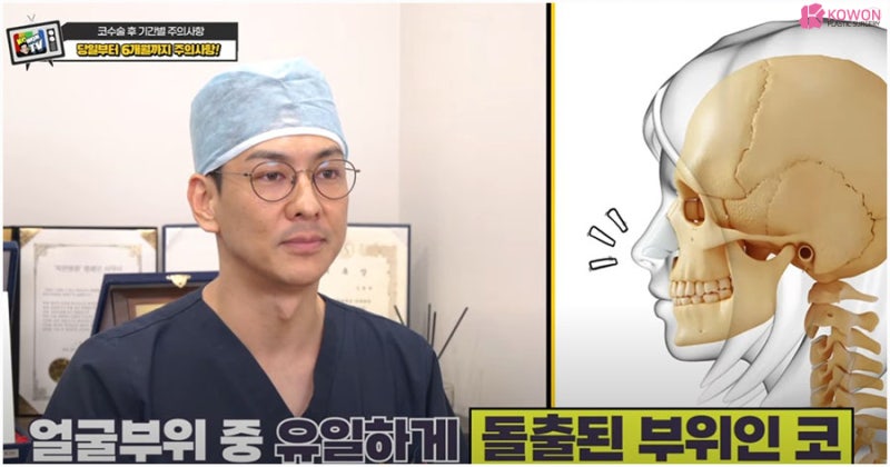 코수술후 주의사항 냉찜질 세안 세수 건조 가습기