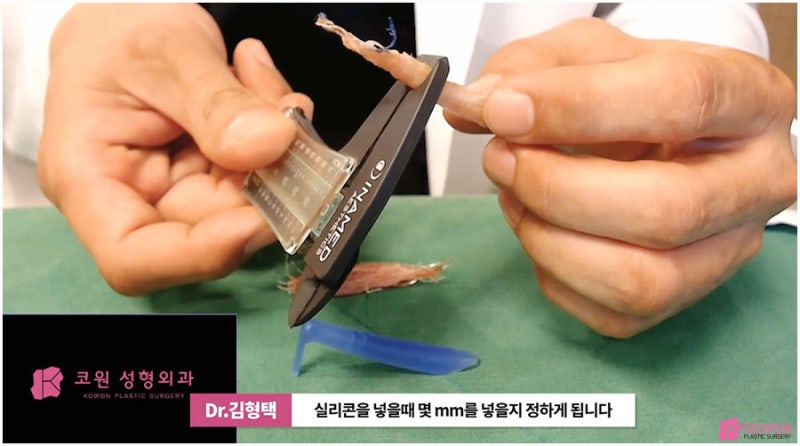 코실제거 서초동성형외과 하이코제거 코울퉁불퉁 사진 13