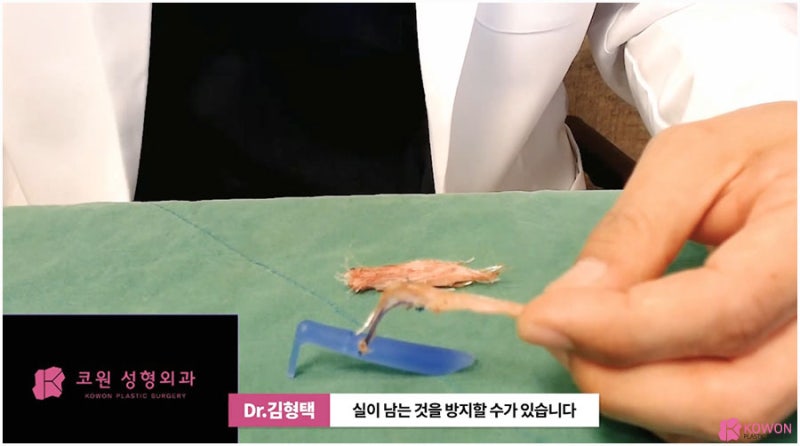 코실제거 서초동성형외과 하이코제거 코울퉁불퉁 사진 11
